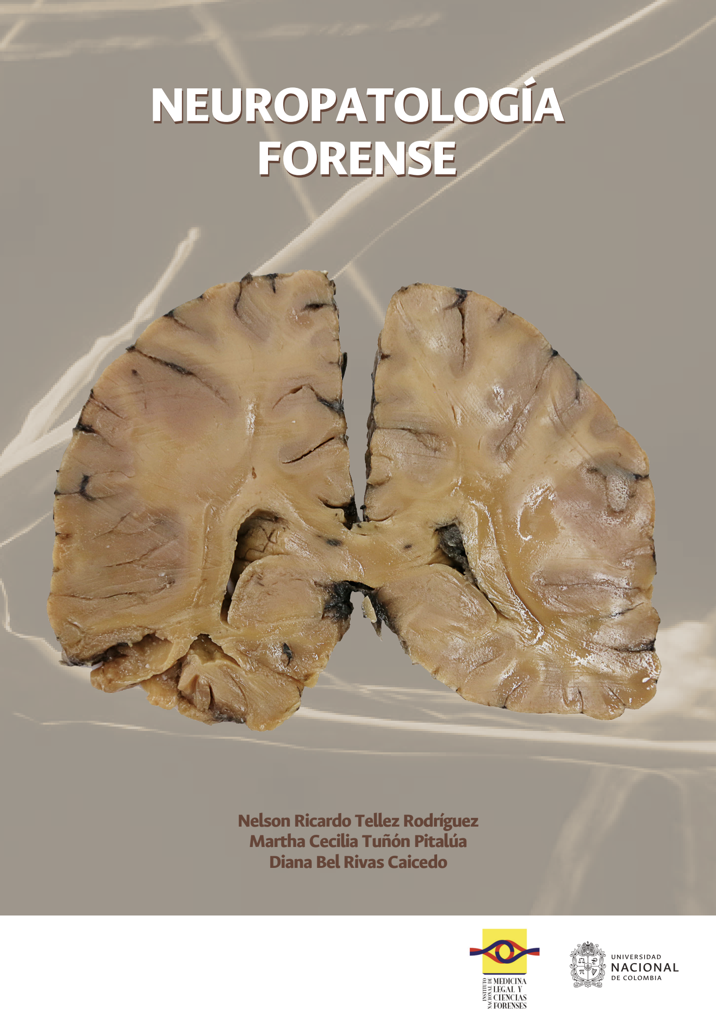 Neuropatología Forense